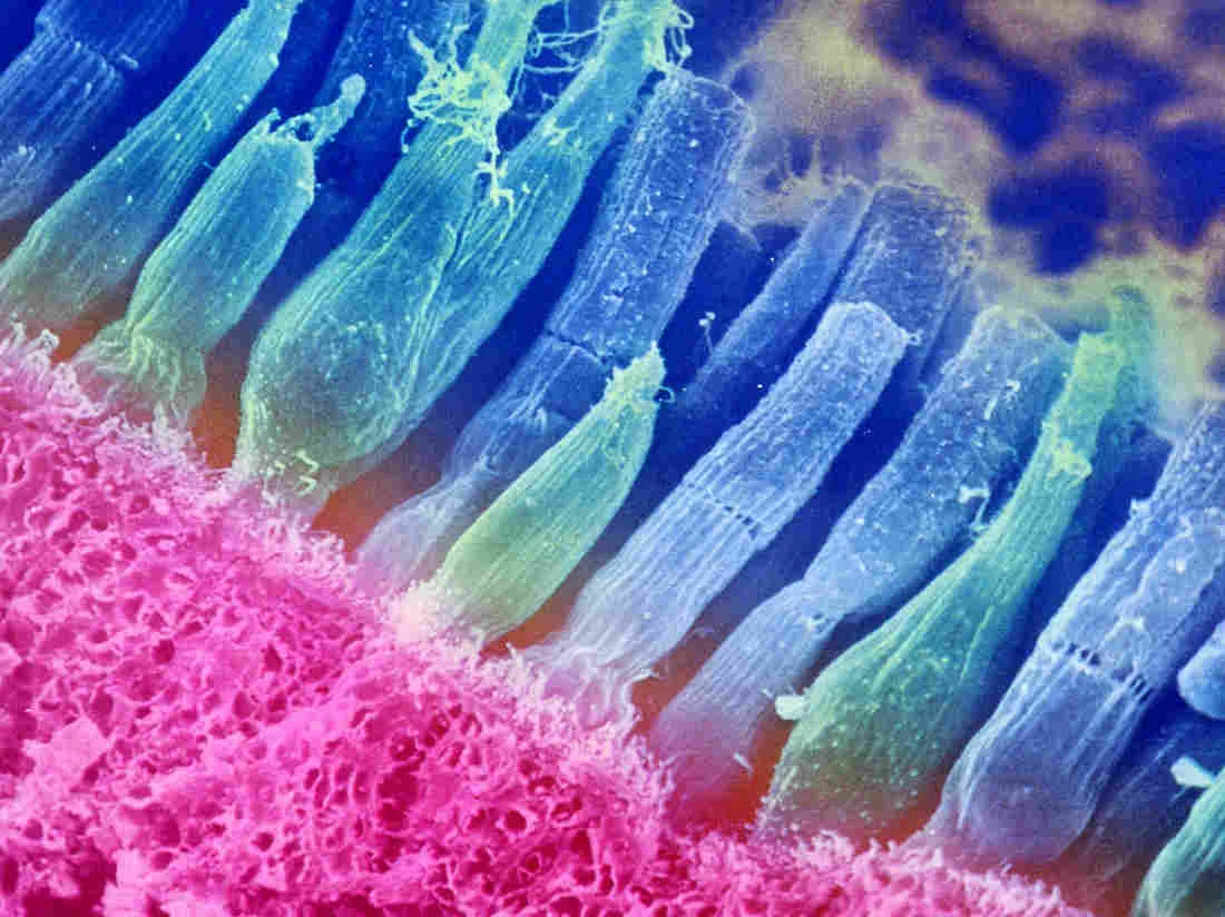 Scientists Find A Brain Circuit That Could Explain Seasonal Depression