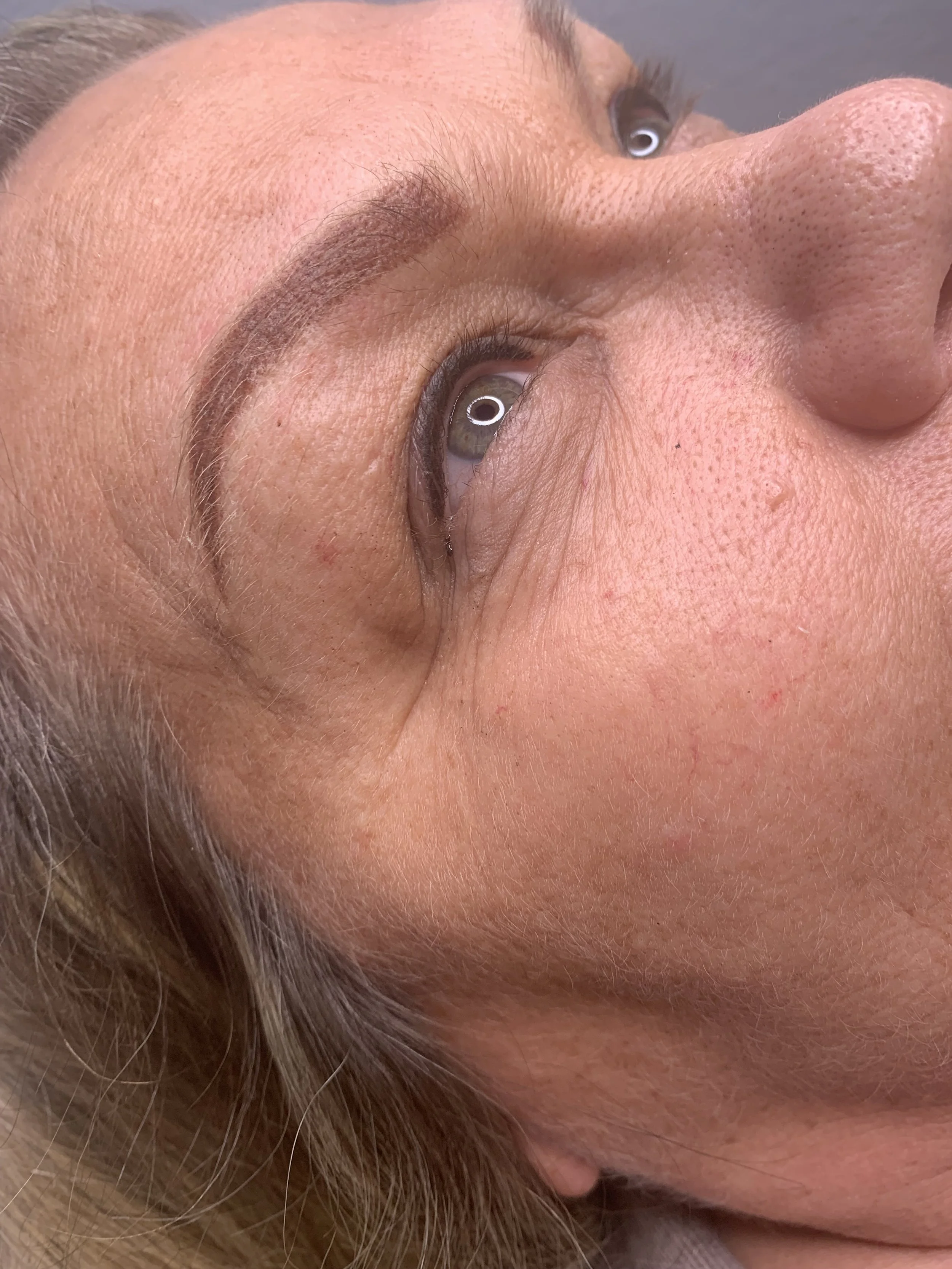 Close-up of a person's face lying sideways, showing eye, skin texture, and facial features.