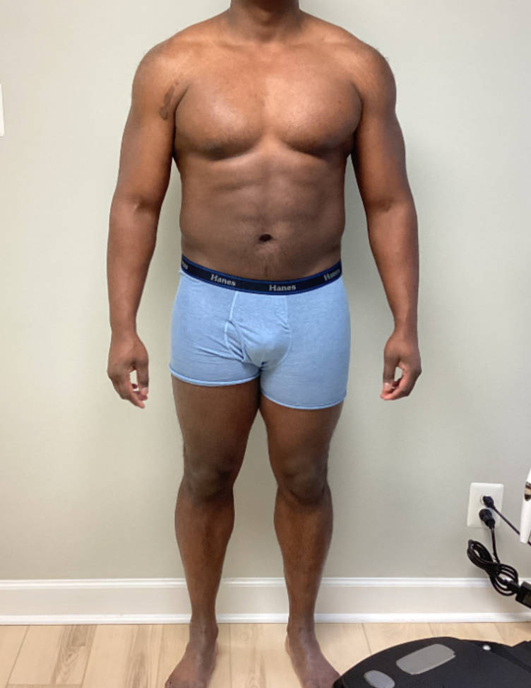 After treatment, Medical Weight Loss