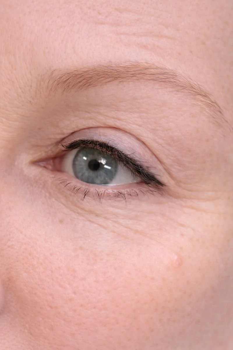 top liner close up.png
