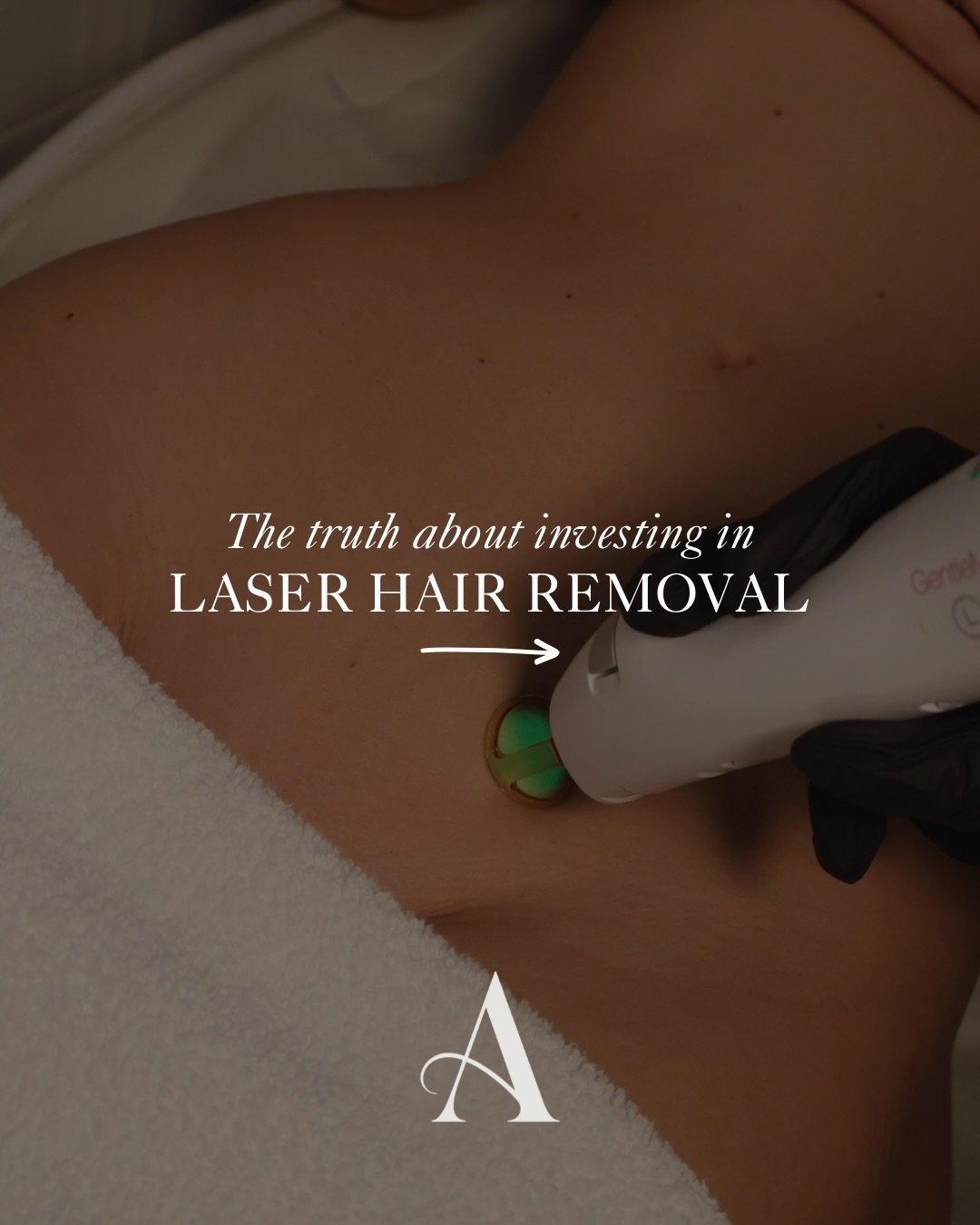 THE TRUTH ABOUT LASER.. ⚡️

Laser hair removal works by targeting pigment in the hair follicles with precise, controlled light. This disables hair growth at the root, reducing hair permanently over a series of treatments. 

Unlike shaving or waxing, 