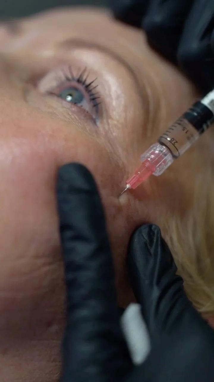 Skin Boosters & Advanced Skin Treatments