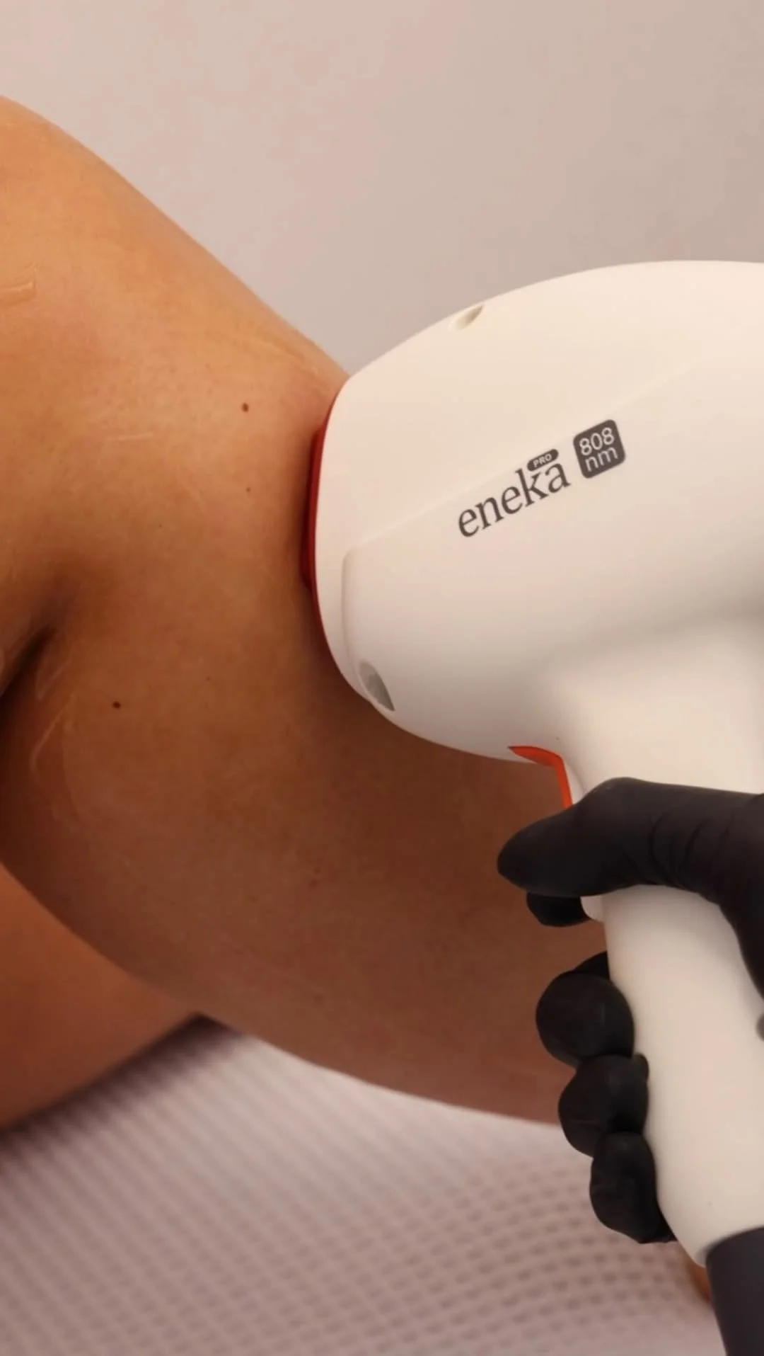 Laser hair removal treatment at The Aesthetic Clinic, South Wales