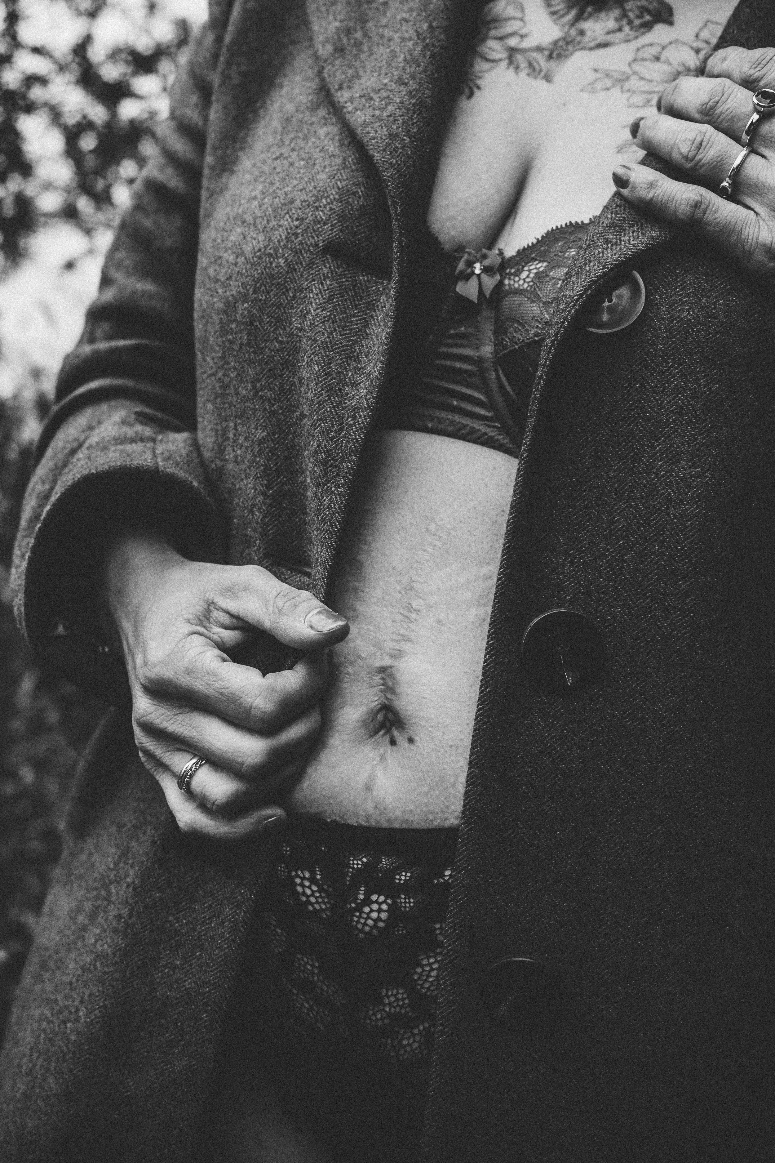 Nahaufnahme eines breiten Bauches mit Narben nach einer Kaiserschnittoperation, teilweise bedeckt von einer Hand mit Ehering und einer Hand, die auf die Brust mit einem schwarzen Spitzen-BH zeigt, vor einem dunklen Anzug. Das Bild ist in Schwarzweiß 