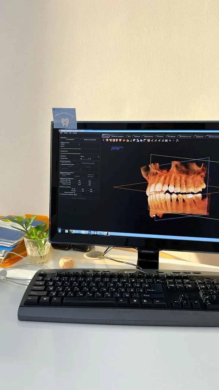 Computer monitor displaying 3D dental X-ray, keyboard, plant, and desktop accessories on a white desk.