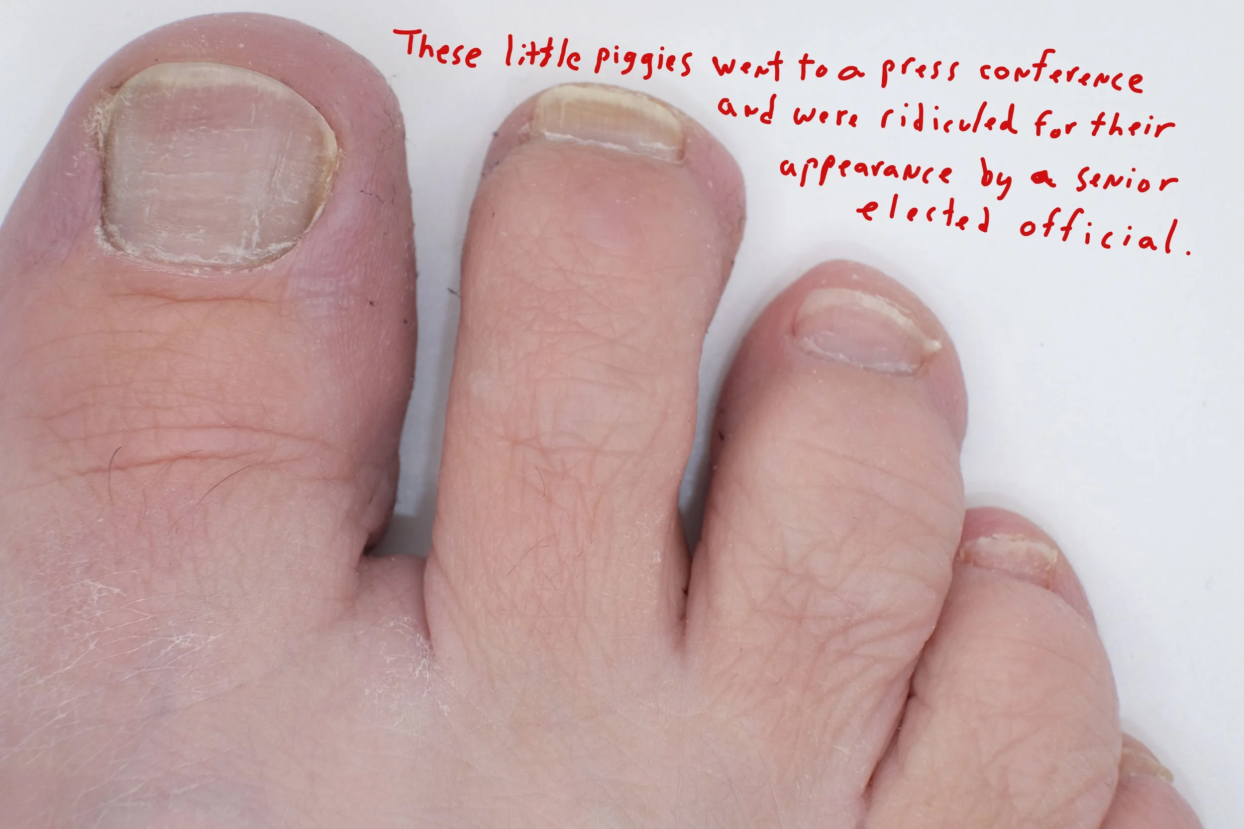  Title: "The Press Conference" Series: These Little Piggies