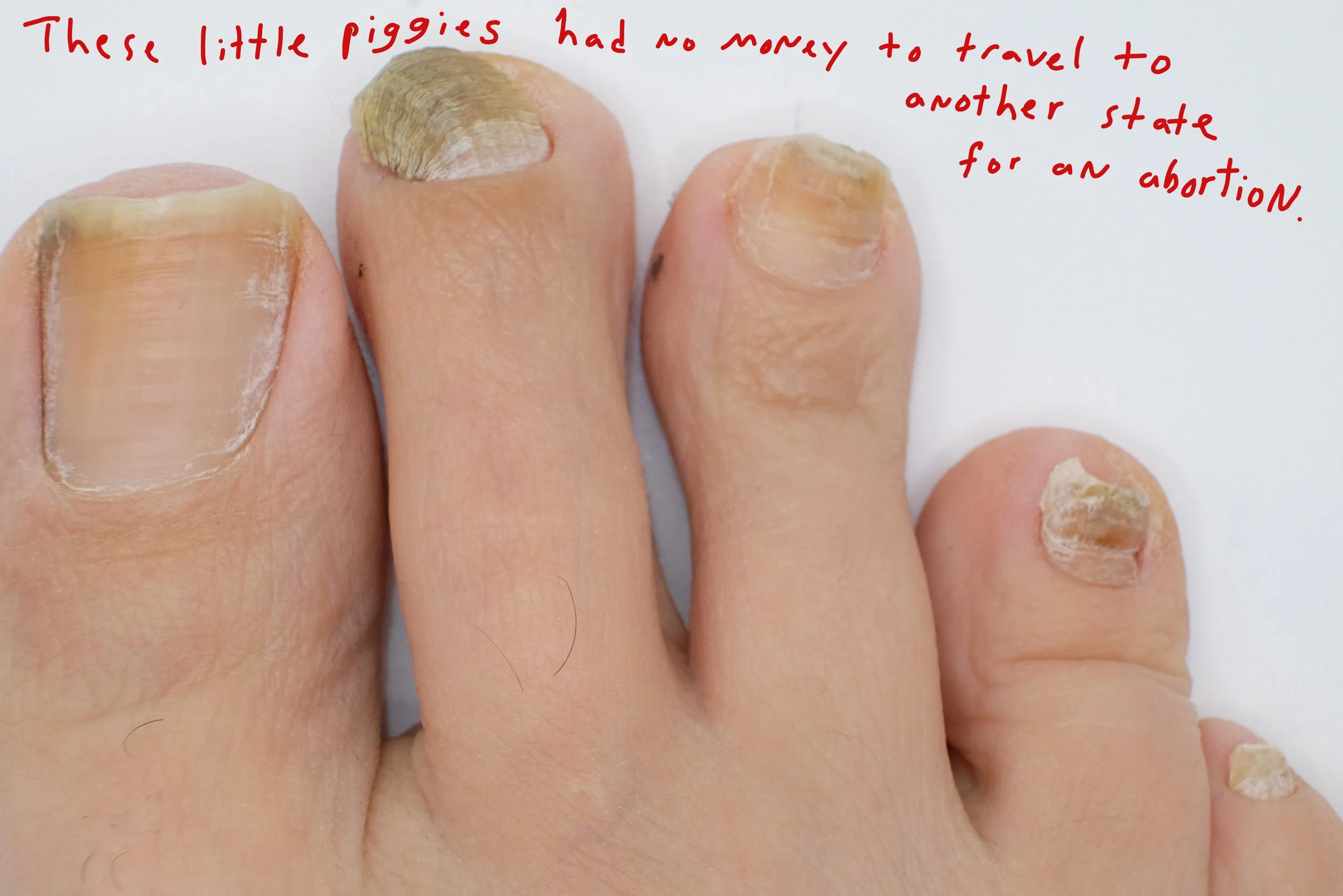  Title: "The Abortion" Series: These Little Piggies