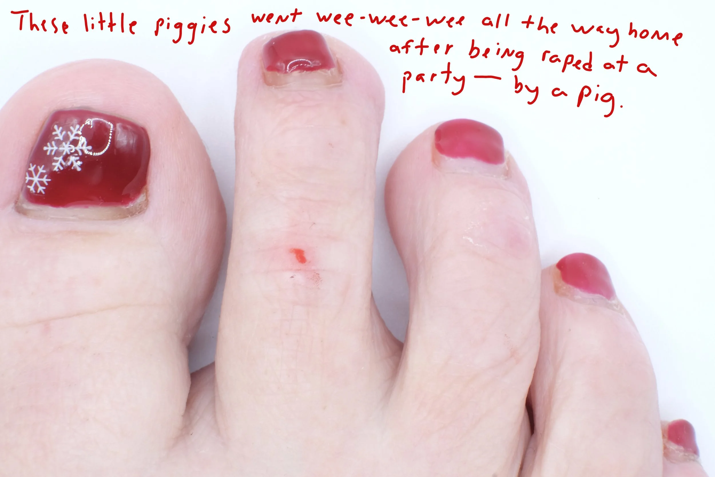  Title: "The Pig" Series: These Little Piggies