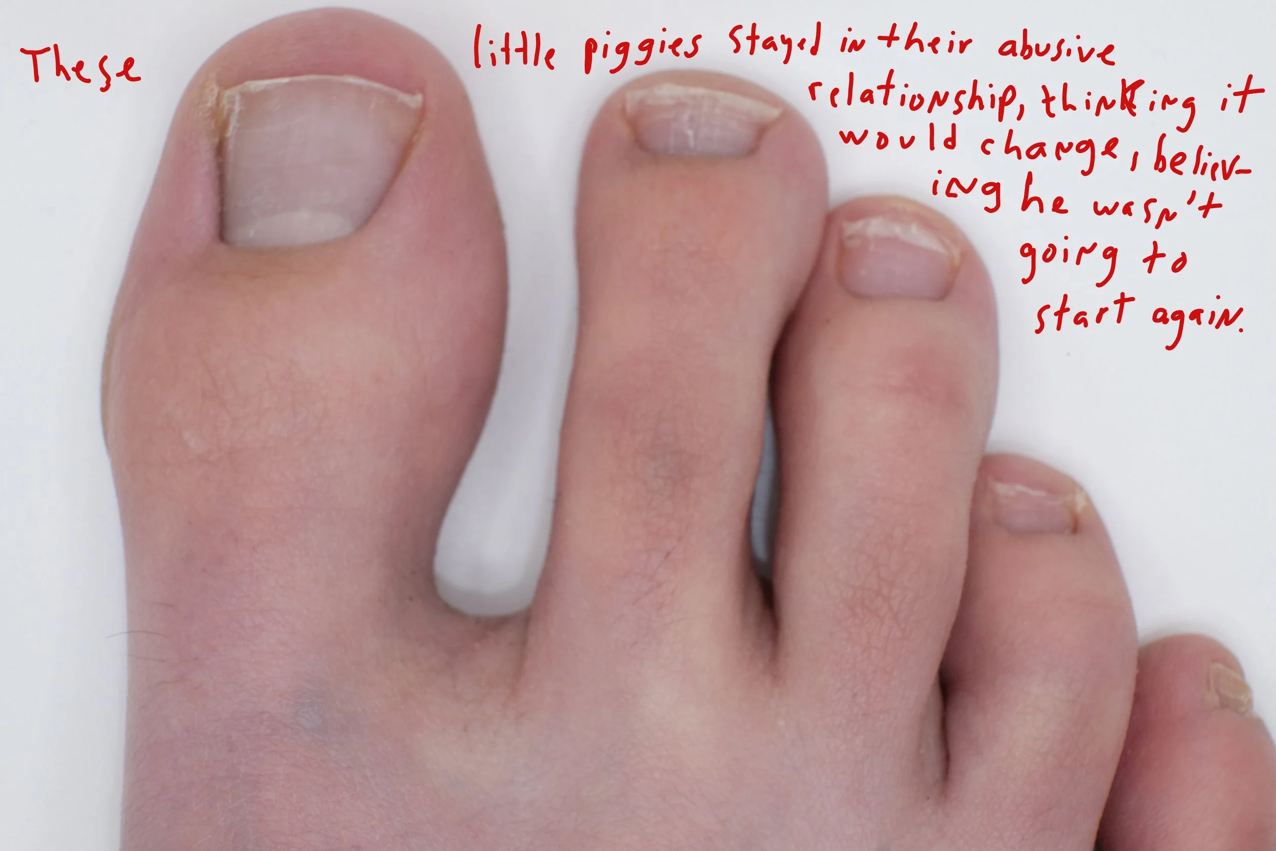  Title: "The Abusive Relationship" Series: These Little Piggies