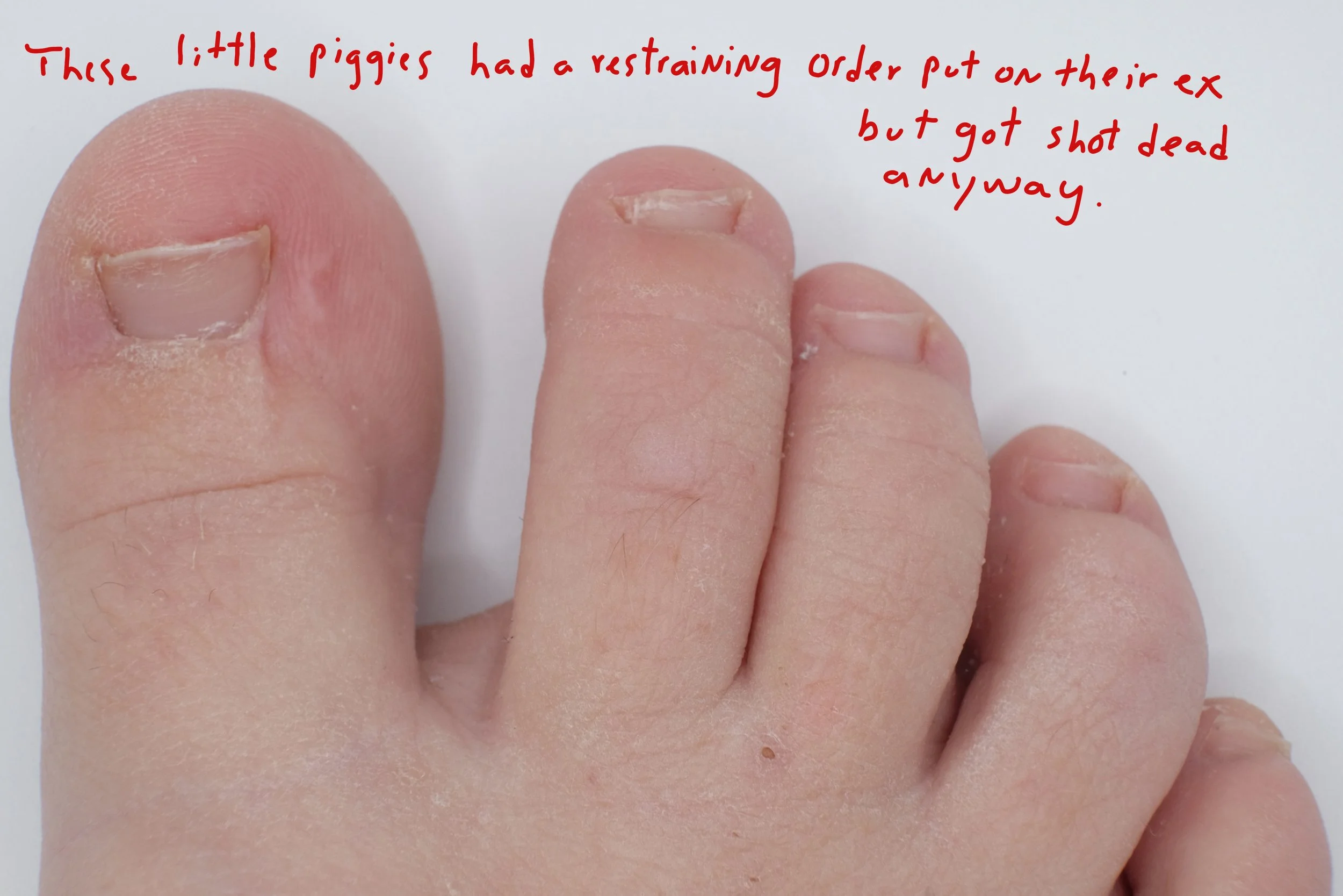  Title: "The Restraining Order" Series: These Little Piggies