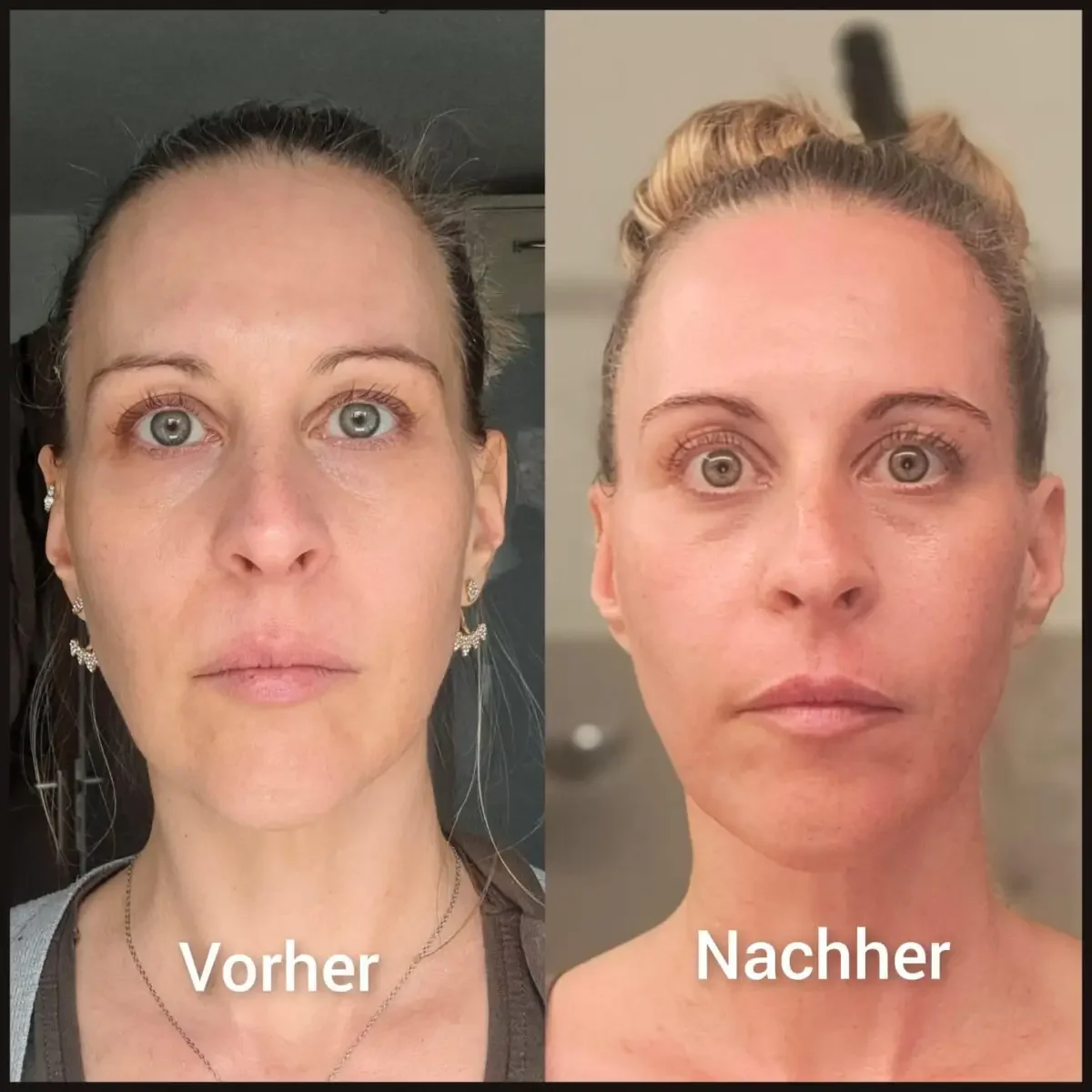 Slow Aging Vorher Nachher.webp