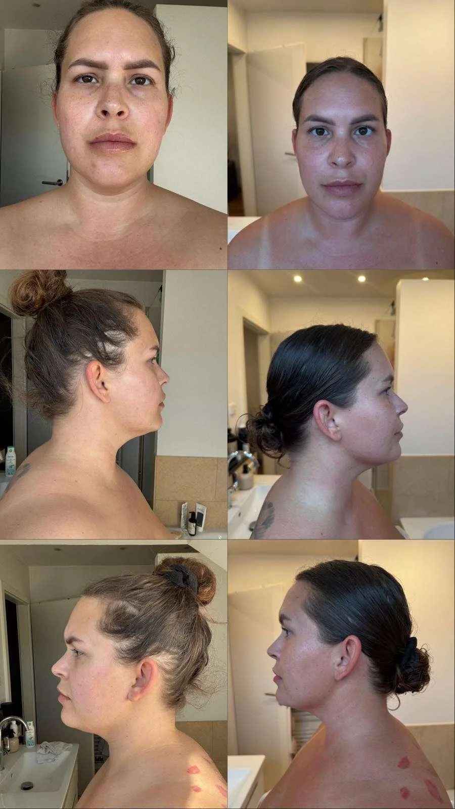 Slow Aging Vorher nachher 4.jpg