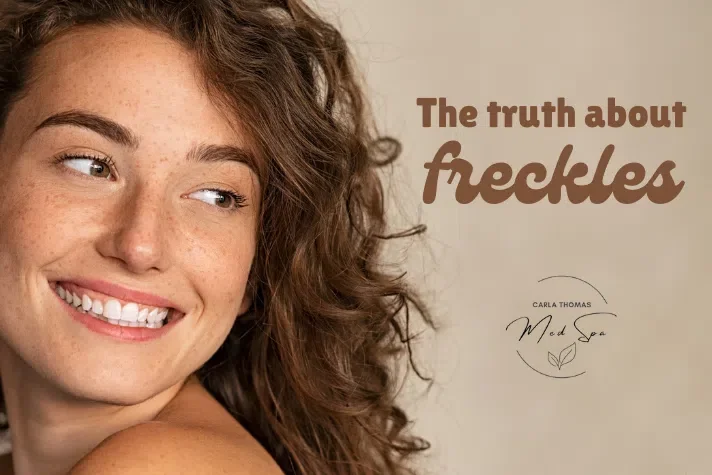 The Truth About Freckles