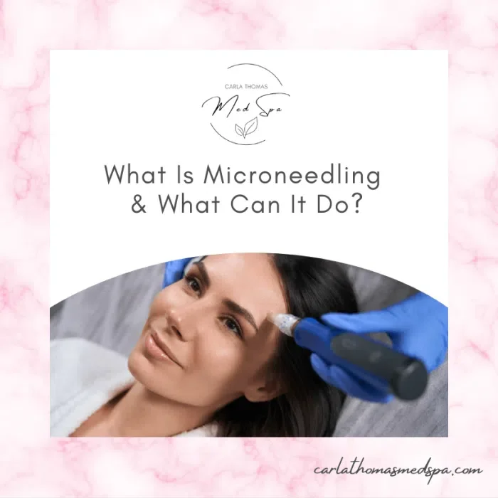 What Is Microneedling &amp; What Can It Do?