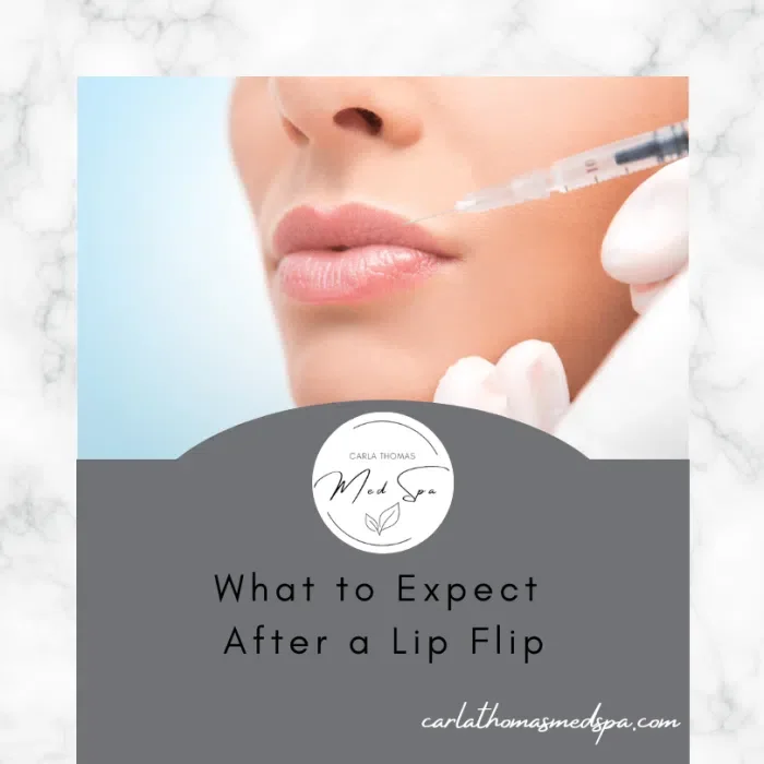 What to Expect After a Lip Flip