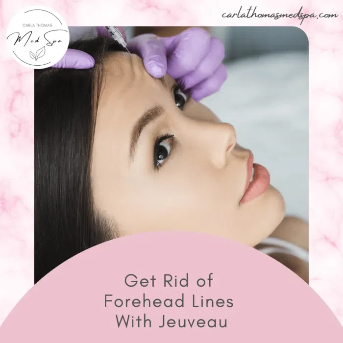 Get Rid of Forehead Lines With Jeuveau