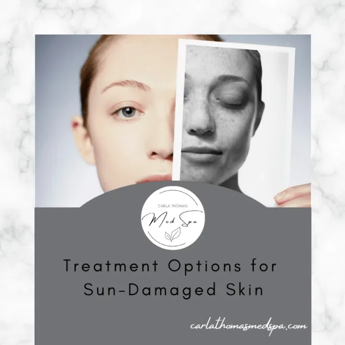 Treatment Options for Sun-Damaged Skin
