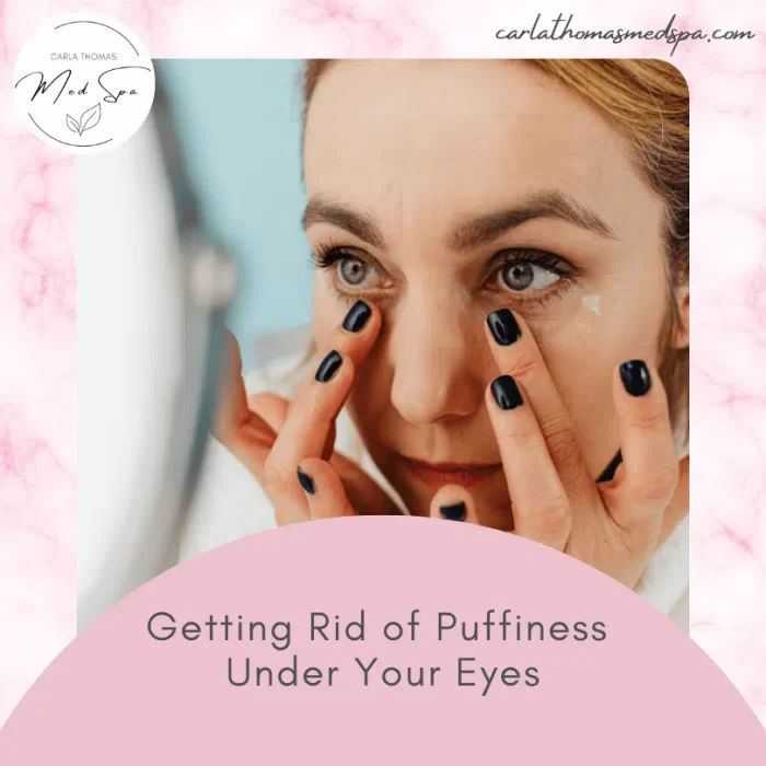 Getting Rid of Puffiness Under Your Eyes