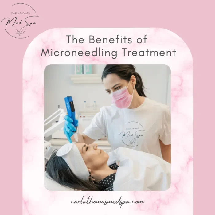 The Benefits of Microneedling Treatment