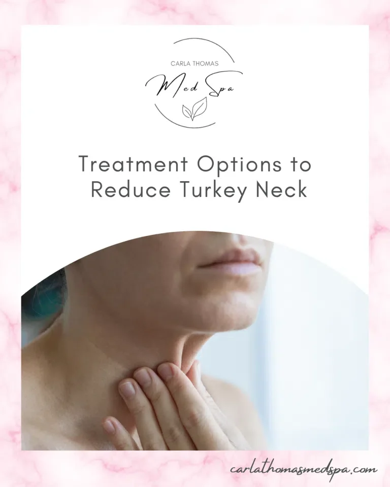 Treatment Options to Reduce Turkey Neck