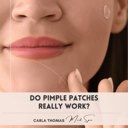 Do Pimple Patches Actually Work?