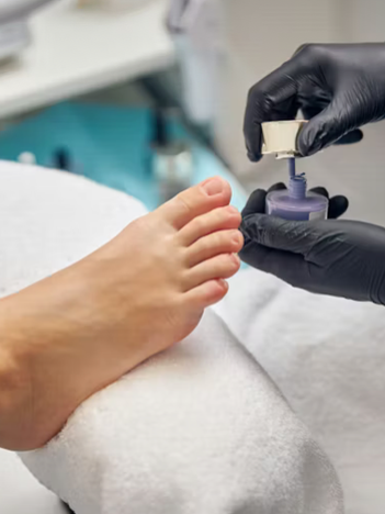 A healthcare professional wearing black gloves applying a treatment or polish to a patient's toenail in a clinical setting.