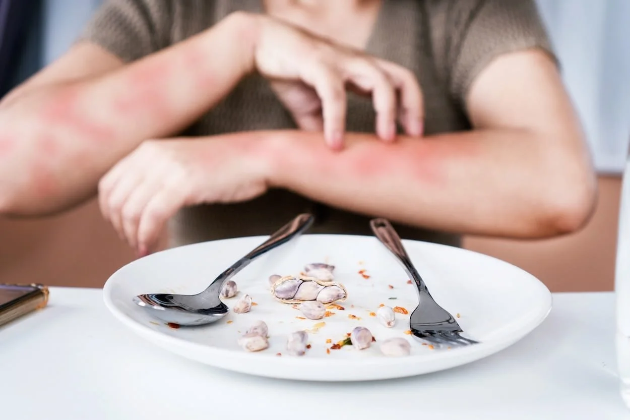 Empty white plate with spilled food, two forks, and some leftover shellfish, with a person scratching their arm in the background.