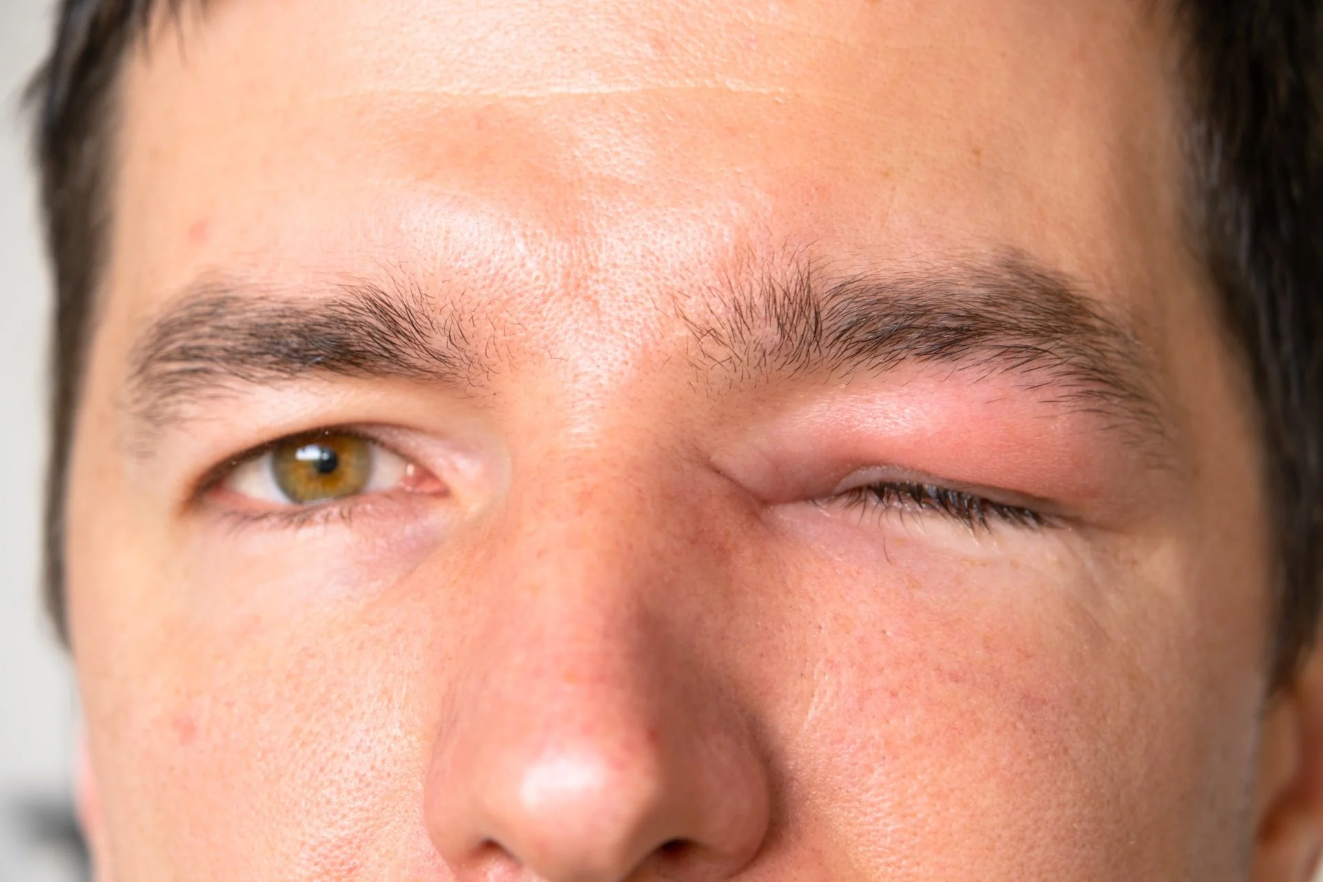 Close-up of a person's face, showing one eye open and the other eye closed, with visible eyebrows and skin texture.
