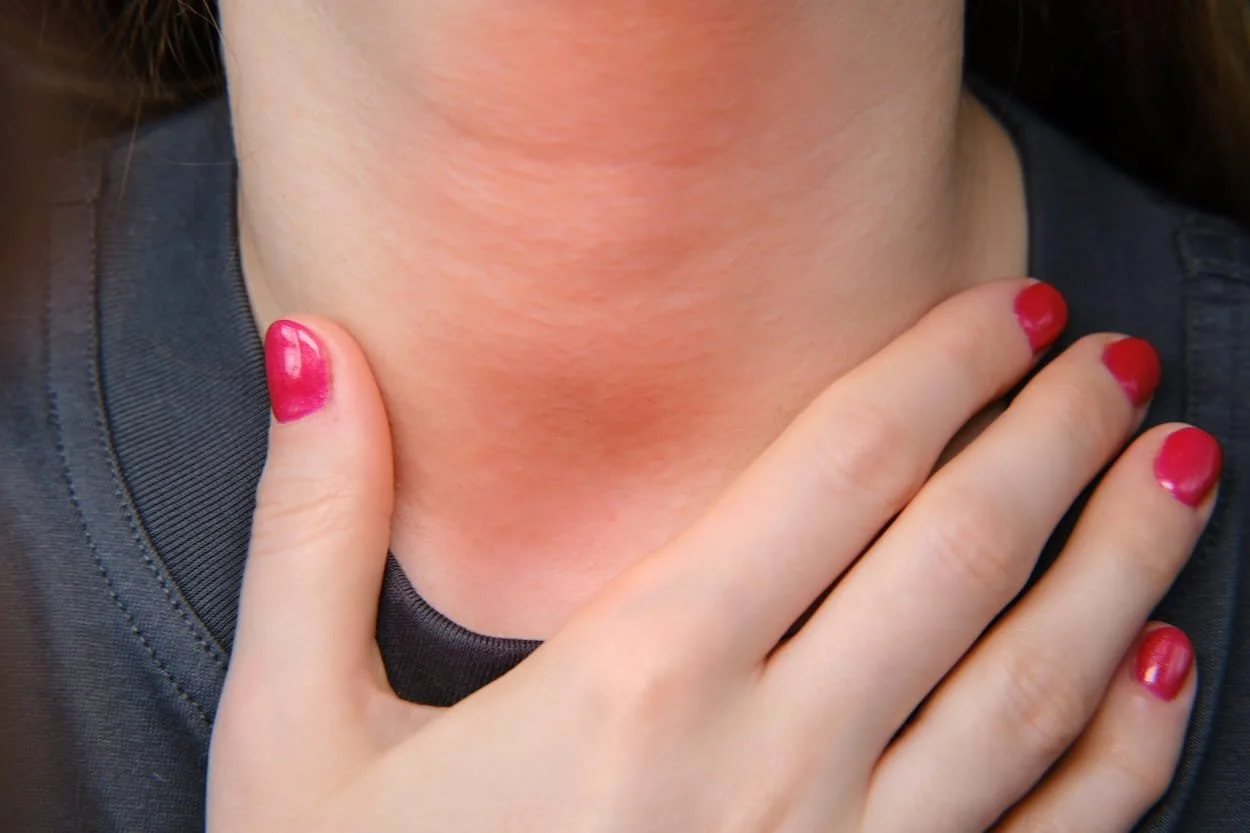 Person with light skin touching their neck with their left hand, fingernails painted red, wearing a dark shirt.