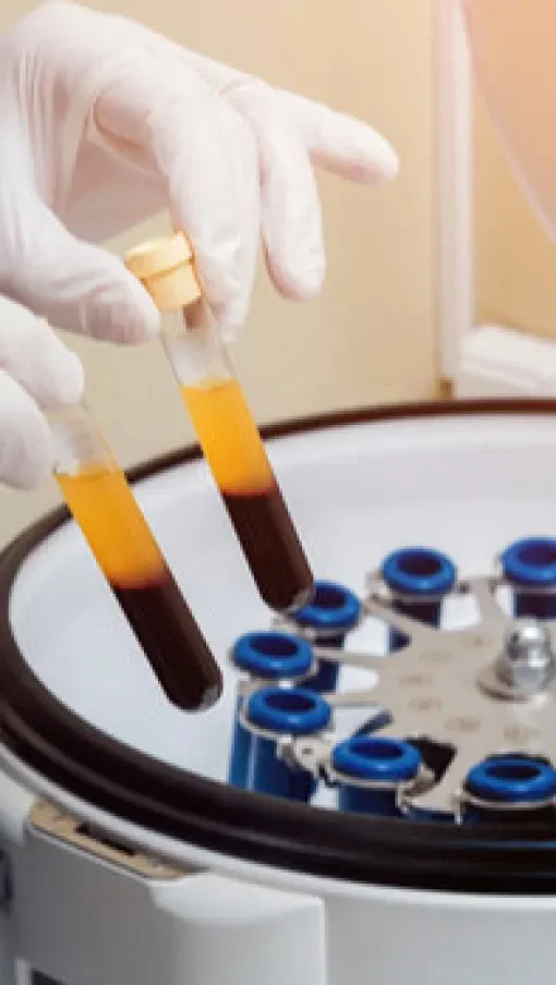 A gloved hand holding two test tubes with orange and dark red liquids, being placed on a centrifuge machine in a lab setting.