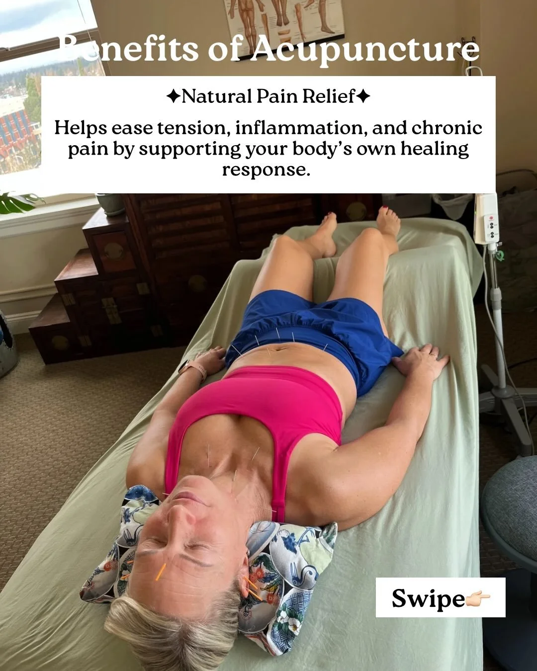 ✨ Your body already knows how to heal &mdash; acupuncture helps remind it.

In a world that constantly asks you to push, rush, and override your body&rsquo;s signals, acupuncture invites you to pause and listen instead. It works with your nervous sys