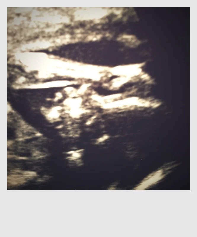 Baby Girl Jones!