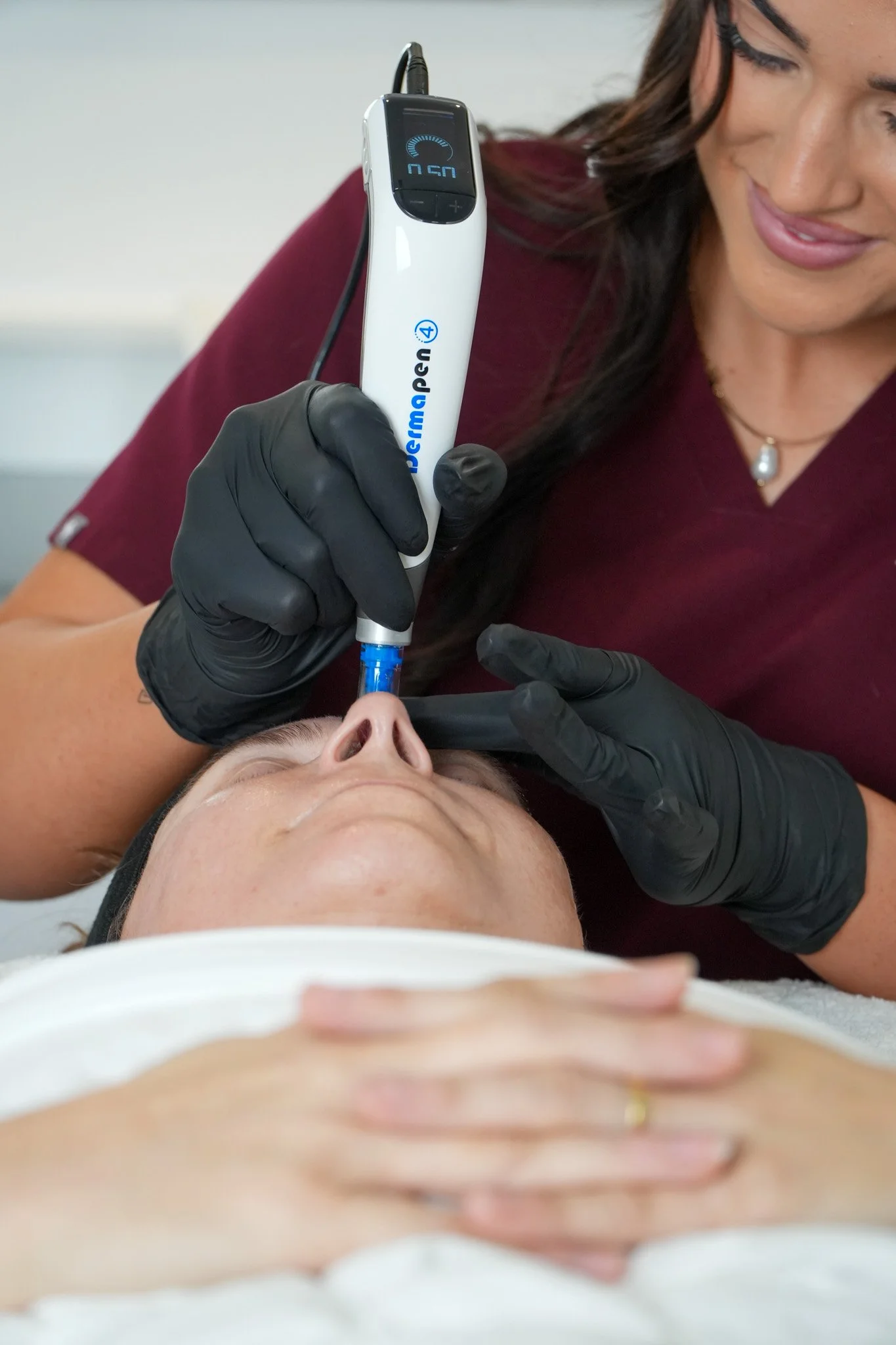 Advanced Microneedling