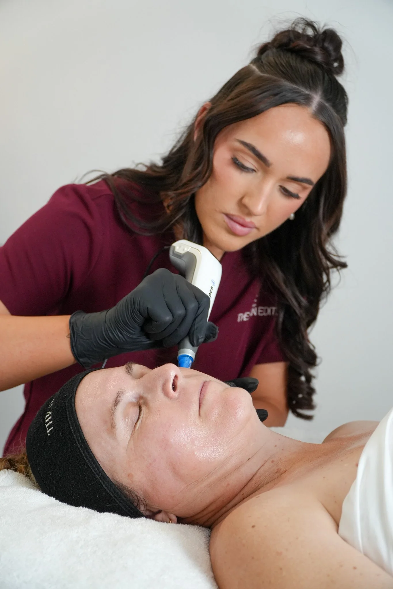 Microneedling