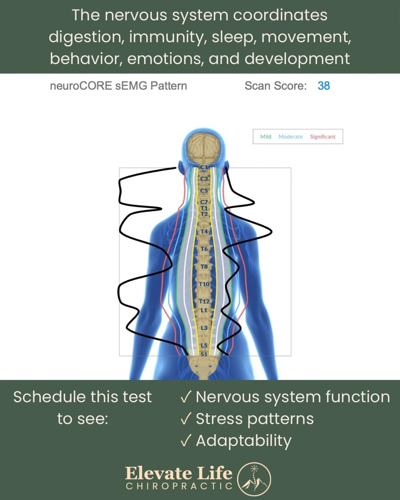 A lot of people ask what makes me different as a nervous system-focused chiropractor, and the main difference is I don&rsquo;t guess, I test the adaptability of your nervous system! 🧠

Elevate Life uses insight CLA technology to look at where your n