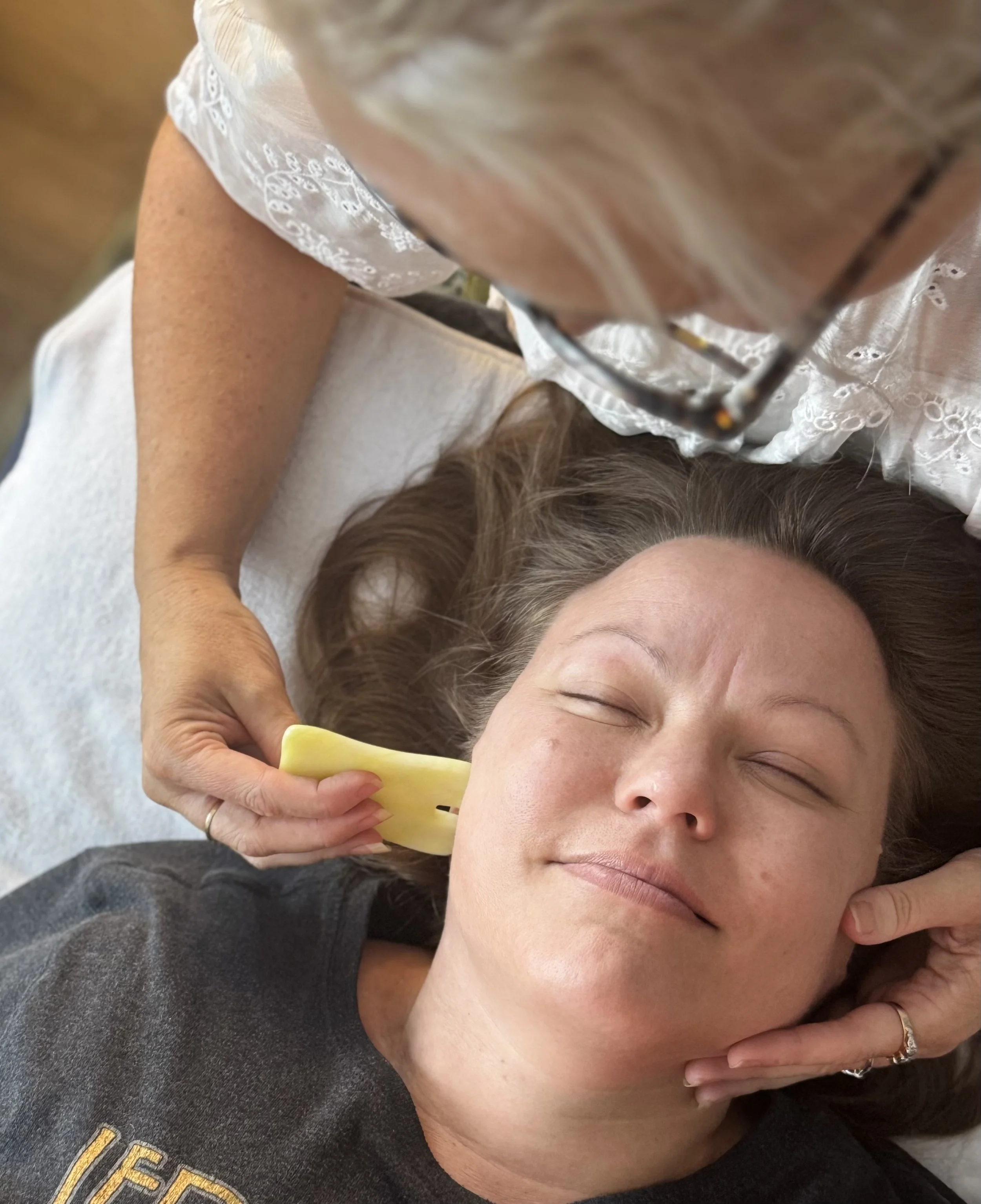 Willow Tree Acupuncture Facial Cosmetic Acupuncture treatment using facial guasha