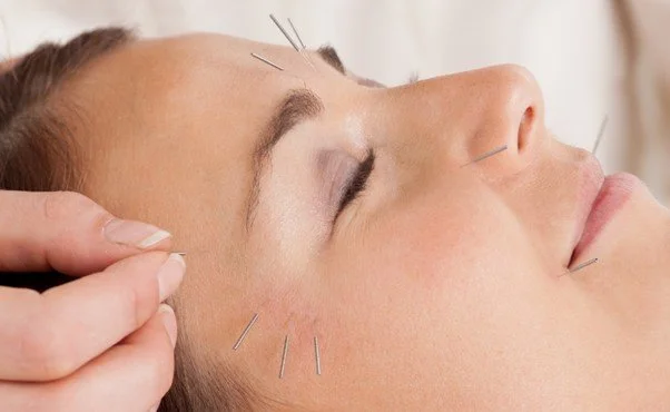 willow tree cosmetic acupuncture.jpg