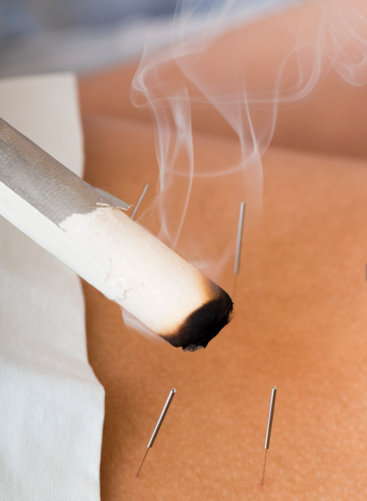 moxa on needle.png