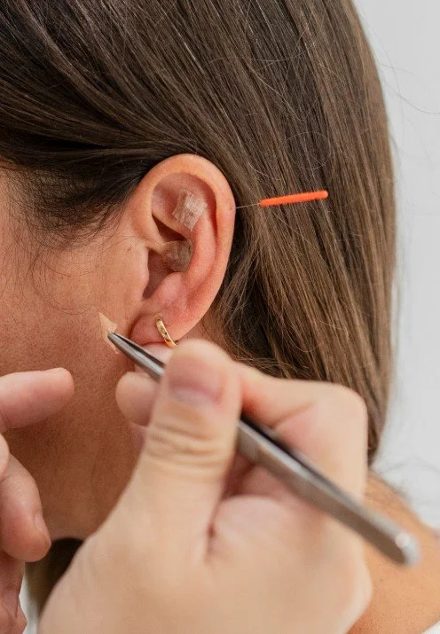 willow tree acupuncture ear seeds and auricular.jpg