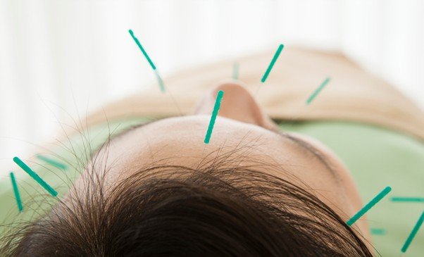 willow tree acupuncture cosmetic green.jpg