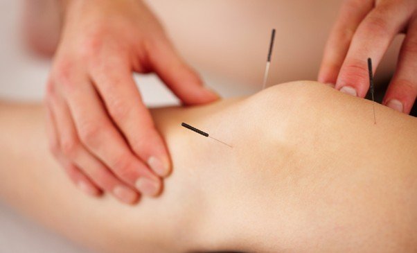 willow tree acupuncture knee.jpg