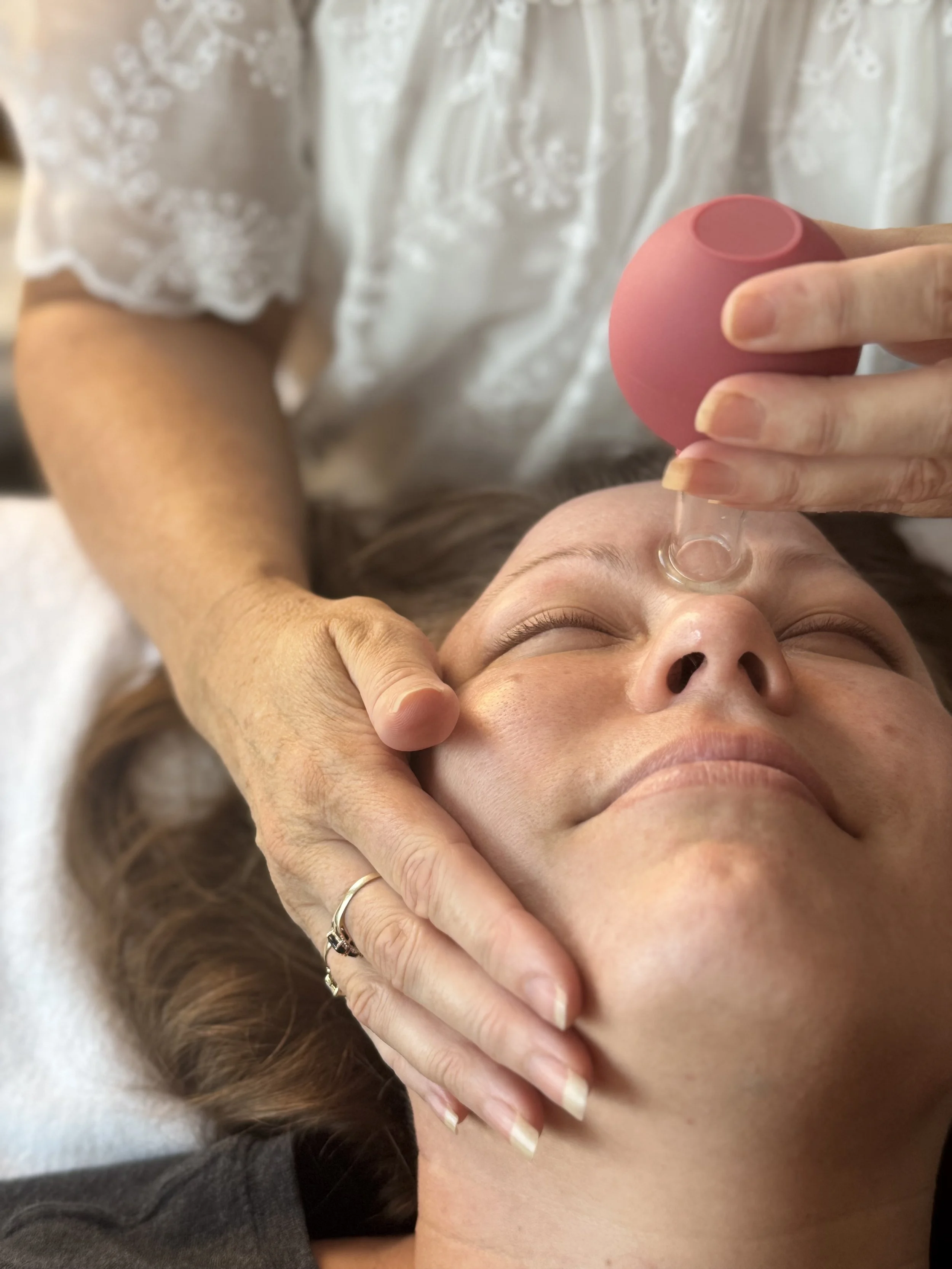Willow Tree Acupuncture Facial Cupping