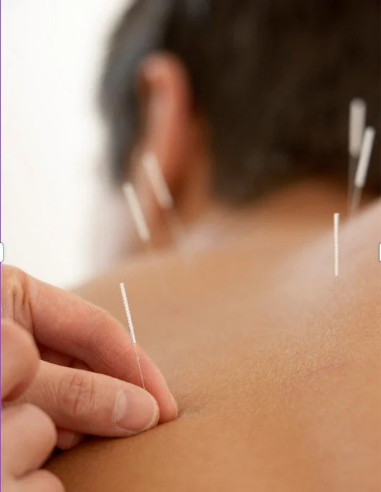 willow tree acupuncture close up shot of needle.jpg