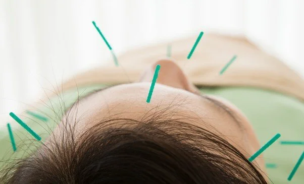 willow tree acupuncture cosmetic green.jpg