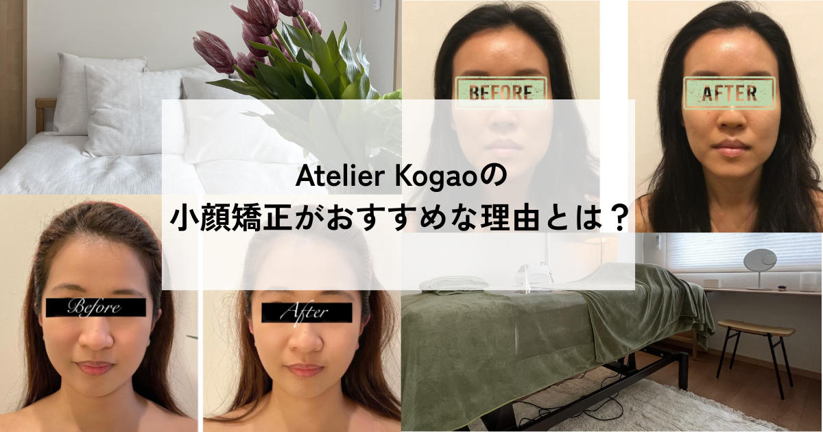 Atelier Kogaoの小顔矯正がおすすめな理由とは？