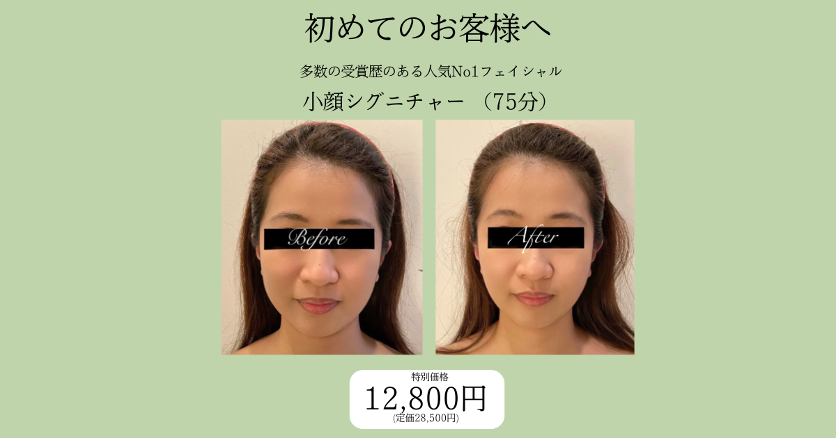 小顔シグニチャー施術によるフェイスラインのビフォーアフター