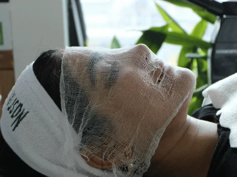 Skin Rejuvenation