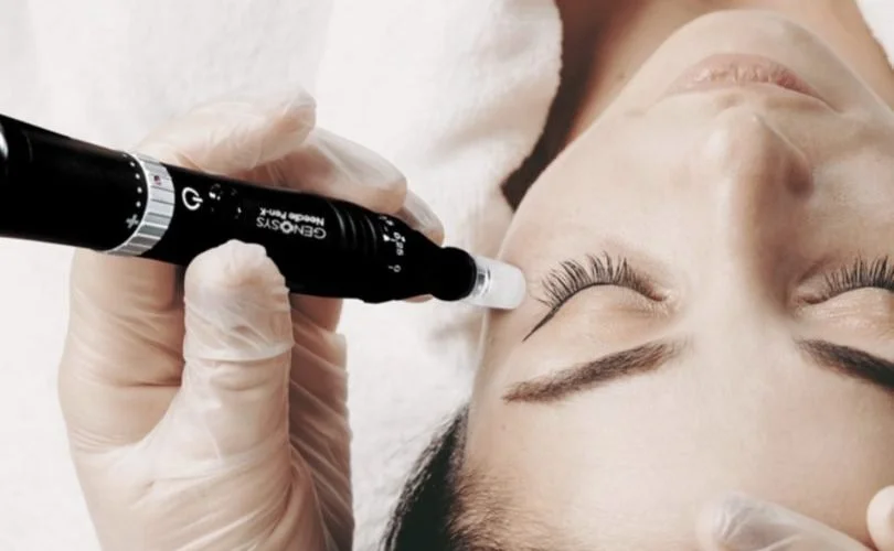 Microneedling pen on face