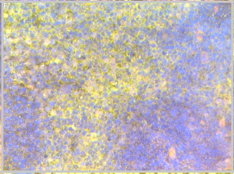 Cellular programming and reprogramming: from somatic cell nuclear transfer to induced pluripotency