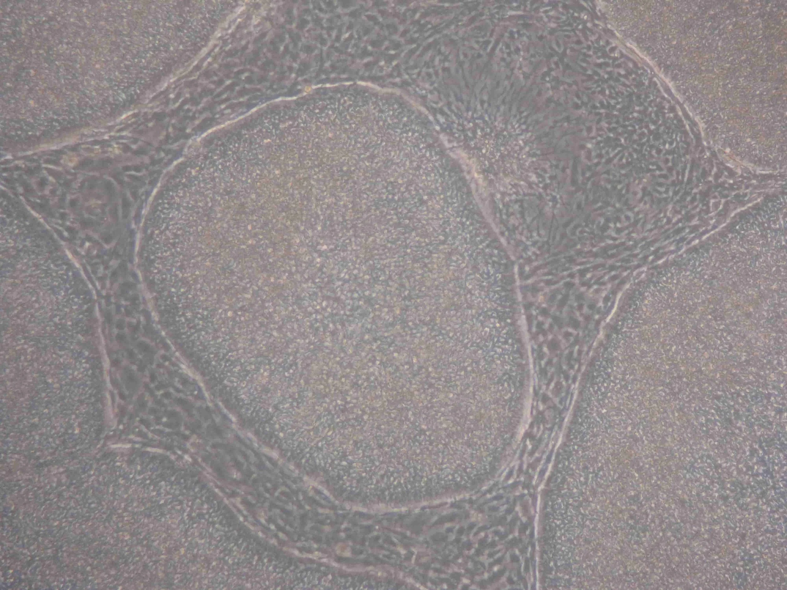 Stem cell types and what distinguishes them: pluripotent, mesenchymal, haematopoietic, neural and cancer
